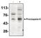 Caspase 6 antibody, NBP2-66612, Novus Biologicals, Western Blot image 