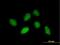 Rhox Homeobox Family Member 1 antibody, H00158800-B01P, Novus Biologicals, Immunofluorescence image 