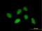 Rhox homeobox family member 1 antibody, H00158800-B01P, Novus Biologicals, Immunofluorescence image 