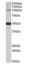 Patched Domain Containing 1 antibody, orb125076, Biorbyt, Western Blot image 