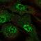 Armadillo Repeat Containing X-Linked 4 antibody, NBP2-55337, Novus Biologicals, Immunofluorescence image 