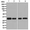 Protein Phosphatase 6 Catalytic Subunit antibody, ab131335, Abcam, Western Blot image 