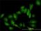 Galectin 1 antibody, H00003956-M01, Novus Biologicals, Immunofluorescence image 