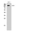 EPH Receptor B1 antibody, STJ92947, St John