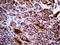 Protein-L-Isoaspartate (D-Aspartate) O-Methyltransferase antibody, LS-C795214, Lifespan Biosciences, Immunohistochemistry paraffin image 