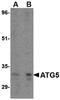 Autophagy Related 5 antibody, PA5-20484, Invitrogen Antibodies, Western Blot image 