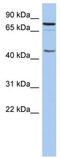 Ring Finger Protein 169 antibody, TA332210, Origene, Western Blot image 