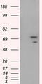 SHC Adaptor Protein 1 antibody, M00796-2, Boster Biological Technology, Western Blot image 