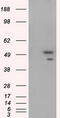 SHC-transforming protein 1 antibody, M00796-2, Boster Biological Technology, Western Blot image 