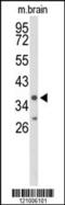 Interleukin 2 Receptor Subunit Gamma antibody, 63-953, ProSci, Western Blot image 