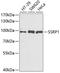 Structure Specific Recognition Protein 1 antibody, A6413, ABclonal Technology, Western Blot image 