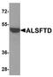 C9orf72-SMCR8 Complex Subunit antibody, A00419, Boster Biological Technology, Western Blot image 