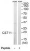 Cystatin 11 antibody, TA326120, Origene, Western Blot image 