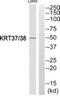 Keratin, type I cuticular Ha7 antibody, PA5-39586, Invitrogen Antibodies, Western Blot image 