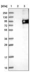 Outer dense fiber protein 2 antibody, PA5-51649, Invitrogen Antibodies, Western Blot image 