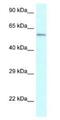 Cytochrome P450 Family 2 Subfamily U Member 1 antibody, NBP1-79914, Novus Biologicals, Western Blot image 