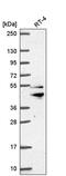 Zinc Finger FYVE-Type Containing 27 antibody, PA5-67081, Invitrogen Antibodies, Western Blot image 