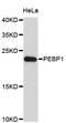 Phosphatidylethanolamine Binding Protein 1 antibody, abx127003, Abbexa, Western Blot image 