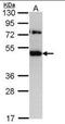Translocating chain-associated membrane protein 1 antibody, orb181725, Biorbyt, Western Blot image 