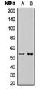 STEAP3 Metalloreductase antibody, LS-C358338, Lifespan Biosciences, Western Blot image 