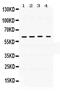 BCL2 Associated Athanogene 3 antibody, PA5-78855, Invitrogen Antibodies, Western Blot image 