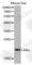 Angiogenin antibody, A1546, ABclonal Technology, Western Blot image 