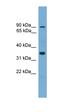 NSE3 Homolog, SMC5-SMC6 Complex Component antibody, orb330941, Biorbyt, Western Blot image 