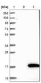 NOTCH Regulated Ankyrin Repeat Protein antibody, NBP1-82665, Novus Biologicals, Western Blot image 