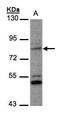 Phosphate-regulating neutral endopeptidase antibody, GTX105991, GeneTex, Western Blot image 