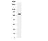 Protein Phosphatase 1 Regulatory Subunit 15B antibody, R30804, NSJ Bioreagents, Western Blot image 