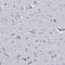 Oligodendrocyte Transcription Factor 2 antibody, NBP1-88634, Novus Biologicals, Immunohistochemistry frozen image 