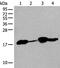 Transmembrane Protein 254 antibody, PA5-67633, Invitrogen Antibodies, Western Blot image 