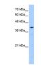 Protein O-Mannosyltransferase 2 antibody, NBP1-60068, Novus Biologicals, Western Blot image 