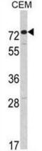 C14 antibody, GTX81590, GeneTex, Western Blot image 