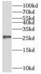 Proteasome Subunit Beta 6 antibody, FNab06875, FineTest, Western Blot image 