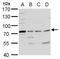 Tyrosyl-DNA Phosphodiesterase 1 antibody, GTX100126, GeneTex, Western Blot image 