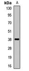 Interferon Gamma Receptor 2 antibody, orb412634, Biorbyt, Western Blot image 