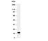 Retinol Binding Protein 2 antibody, R30820, NSJ Bioreagents, Western Blot image 