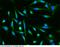 Ras Homolog Family Member A antibody, 12441-MM03, Sino Biological, Immunohistochemistry paraffin image 