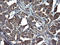 Tubulin Alpha 1a antibody, LS-C797723, Lifespan Biosciences, Immunohistochemistry paraffin image 