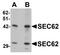 SEC62 Homolog, Preprotein Translocation Factor antibody, TA319720, Origene, Western Blot image 