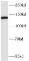 ERC1 antibody, FNab02830, FineTest, Western Blot image 