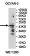 Zinc Finger Protein 662 antibody, orb78299, Biorbyt, Western Blot image 