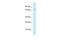 Amyloid Beta Precursor Protein Binding Family B Member 2 antibody, PA5-70129, Invitrogen Antibodies, Western Blot image 