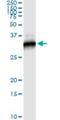 RPTOR Independent Companion Of MTOR Complex 2 antibody, H00253260-M01, Novus Biologicals, Immunoprecipitation image 