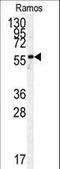 Pyruvate Kinase M1/2 antibody, LS-C98973, Lifespan Biosciences, Western Blot image 