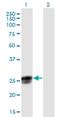 Neugrin, Neurite Outgrowth Associated antibody, H00051335-B01P, Novus Biologicals, Western Blot image 