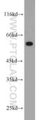 Chaperonin Containing TCP1 Subunit 5 antibody, 11603-1-AP, Proteintech Group, Western Blot image 