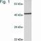 Calcium/Calmodulin Dependent Protein Kinase I antibody, NB600-1163, Novus Biologicals, Western Blot image 