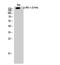 Insulin Receptor Substrate 1 antibody, A00268S794-2, Boster Biological Technology, Western Blot image 